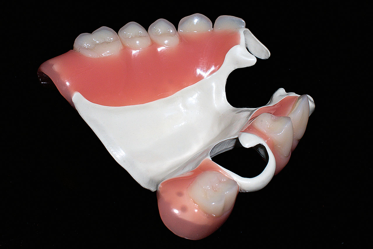 Abb. 11b ... okklusal (Fotos: Ralph Riquier/Solvay Dental 360).