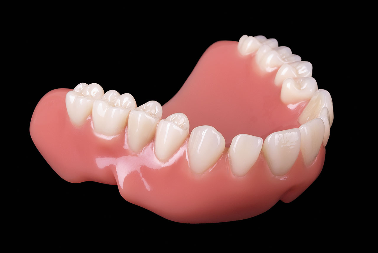 Abb. 9 Prothese mit eingeklebten Zähnen.