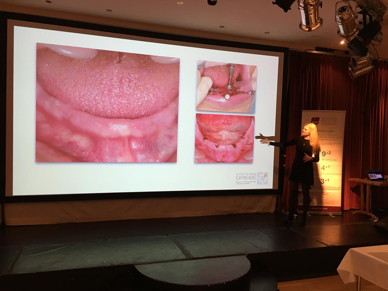 Dr. Melanie Grebe leitete einen Workshop zur Kommunikation zwischen Zahnarzt und Dentallabor ...
