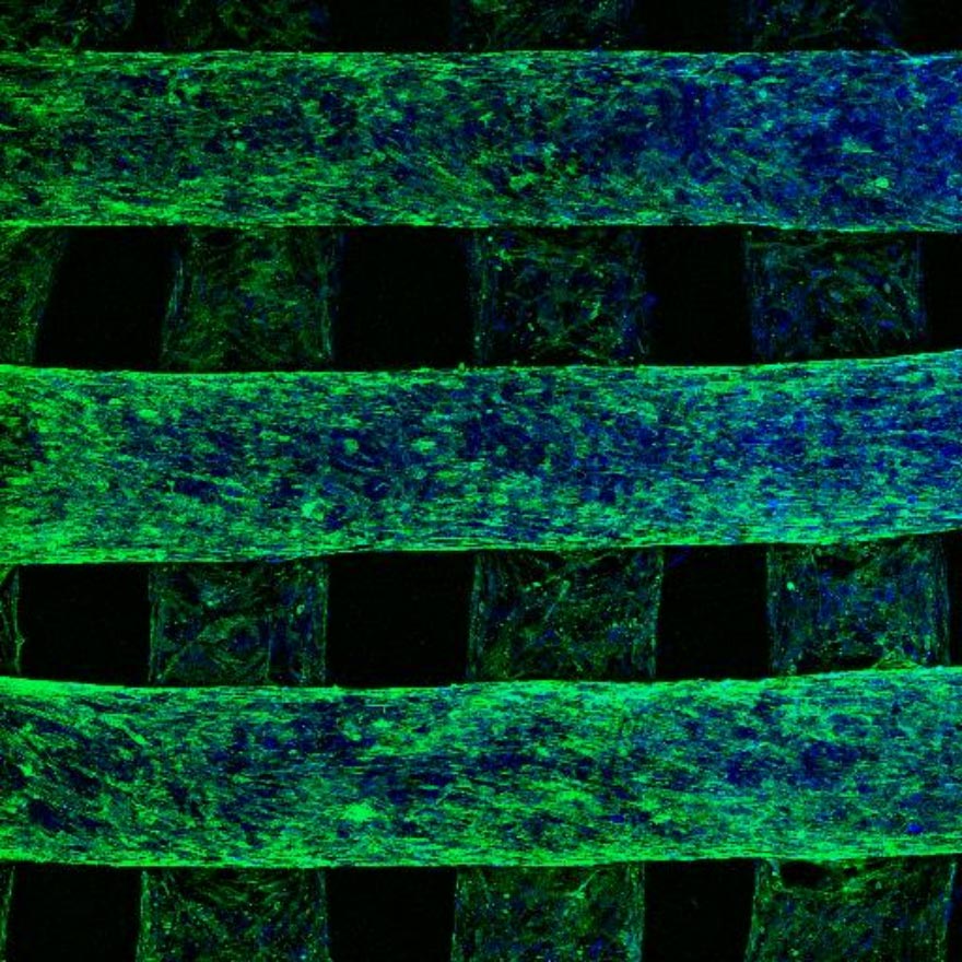 Abb. 5: Zellen, die auf gedruckte Scaffoldstrukturen gesiedelt werden, orientieren sich entlang der Stränge und proliferieren. In diesem Bild wurde das Strukturprotein Aktin angefärbt, welches die äußere Form von Zellen verrät. Die Färbung zeigt die hohe Cytokompatibilität gedruckter Kalziumphosphatscaffolds.