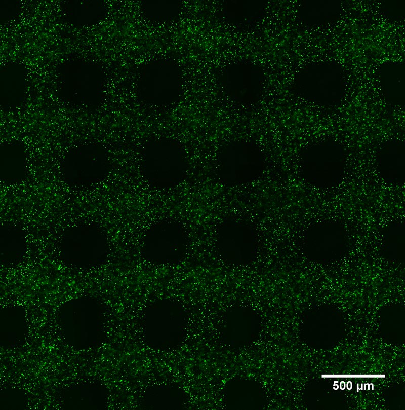 Abb. 7: Biodruck von Zellen. Im vorliegenden Bild ist jede lebende Zelle grün angefärbt. Die Zellen sind im Hydrogel homogen verteilt und lassen sich beliebig und strangweise im Scaffold anordnen.Abb. 8: Biogedruckte Scaffolds sollen die Einheilung fördern, unter anderem, indem sie die Nährstoffversorgung erhöhen. In einem innovativen Ansatz können Kern/Mantel-Strukturen gedruckt werden, in dem jeder Strang einen zellulären Kern (hier blau angefärbt) besitzt, der umliegendes Gewebe unterstützt
