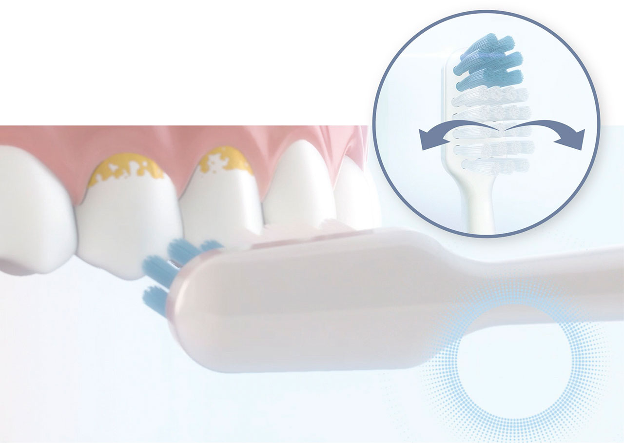 Mechanische Wirkung: Die Borsten von Vitus sonic vibrieren mit Hochfrequenz auf der Zahnoberfläche und entfernen so effektiv Plaque.