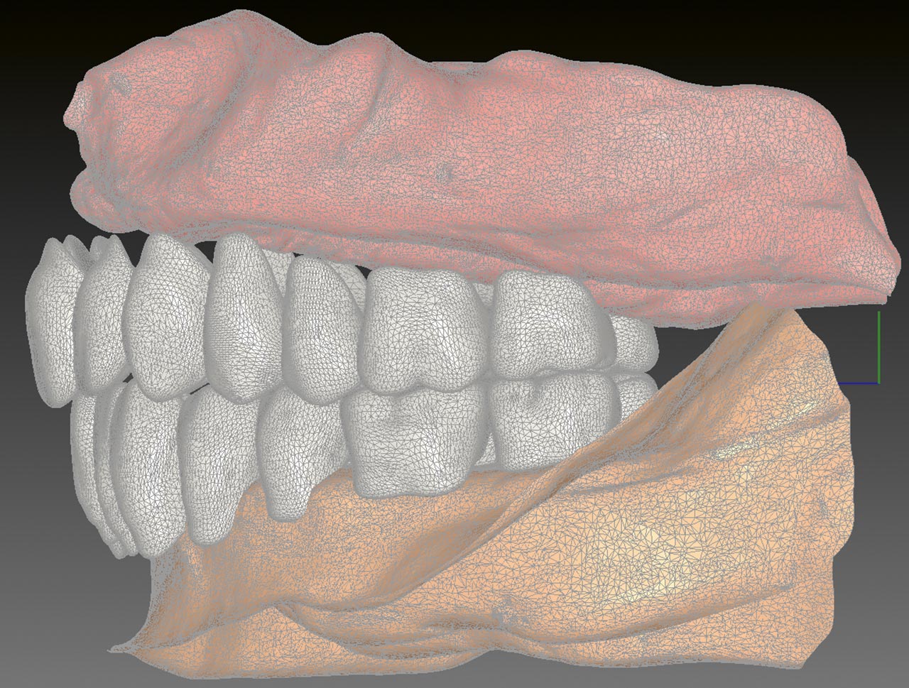 Abb. 16 Linkslaterale Ansicht der polygonisierten Modelle der Zahnreihen und unbezahnten Kämme.