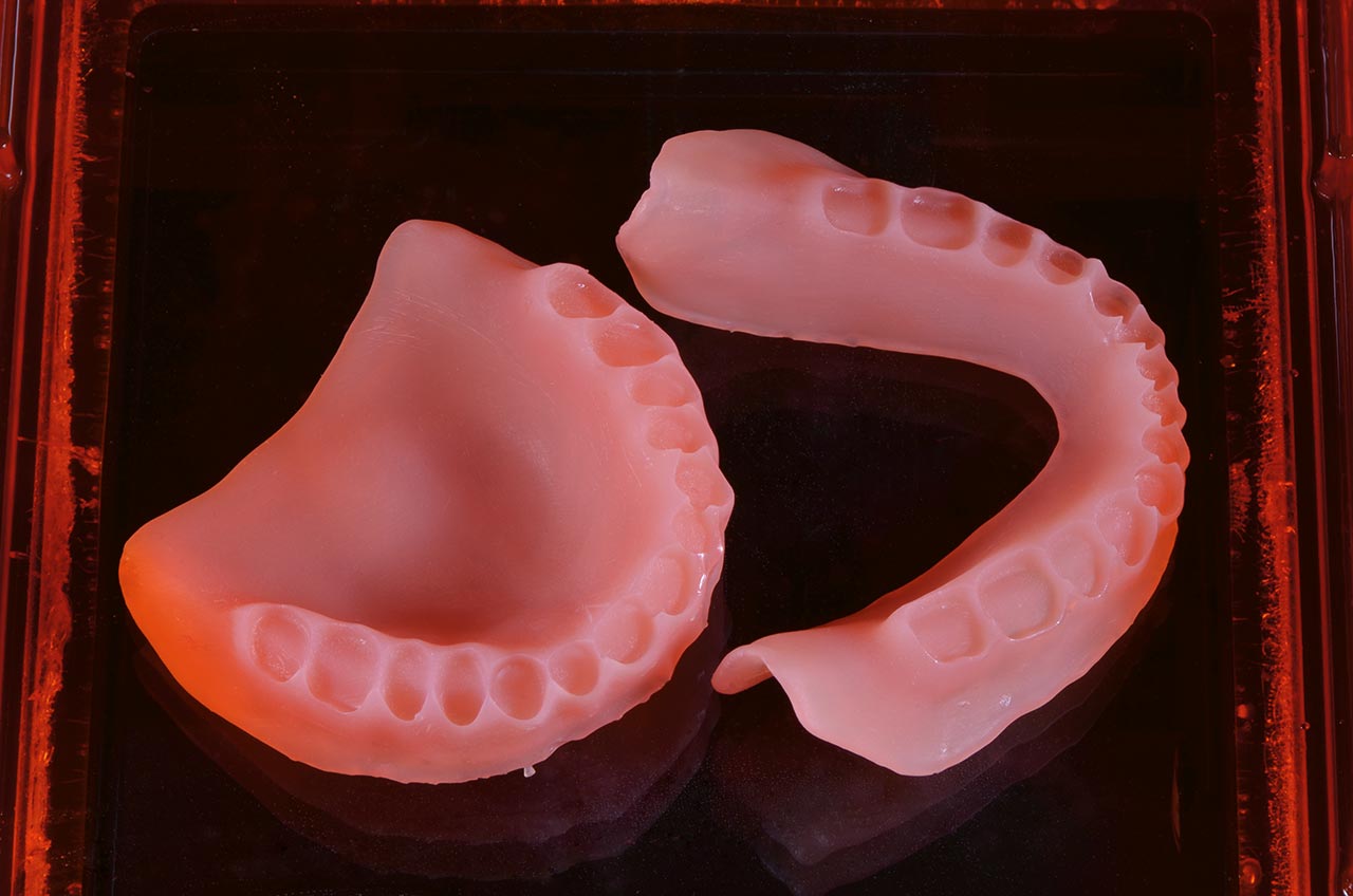 Abb. 31 Ober- und Unterkieferprothesenbasis nach dem Druck, mit Zahnfleischstrukturen und Aussparungen für die Zähne.