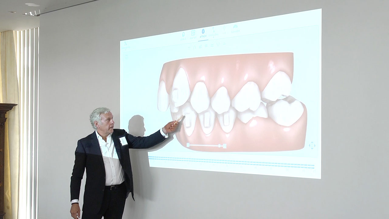 Dr. Werner Schupp erläuterte das Potenzial von Alignern in der KfO. (Foto: QTV)
