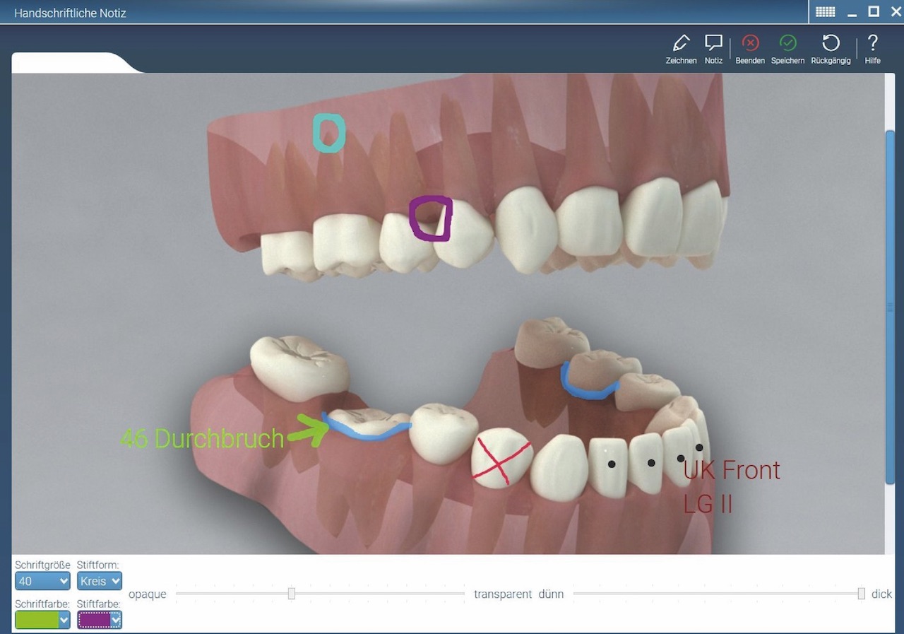 Im 3D-Patientenberater Pro können Zeichnungen und Anmerkungen eingefügt und gespeichert werden. (Foto: CGM)