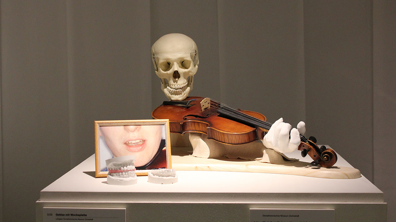 Musiker und Zahnmedizin – Ausstellungen zu dieser speziellen Kombination gab es schon zu Louis Spohr in Kassel und Richard Wagner in Dresden/Graupa. Hier zu sehen ist die Verschiebung des Unterkiefers durch das Anlegen einer Geige – und wie man dem entgegnen kann. (Foto: Dentalmuseum)