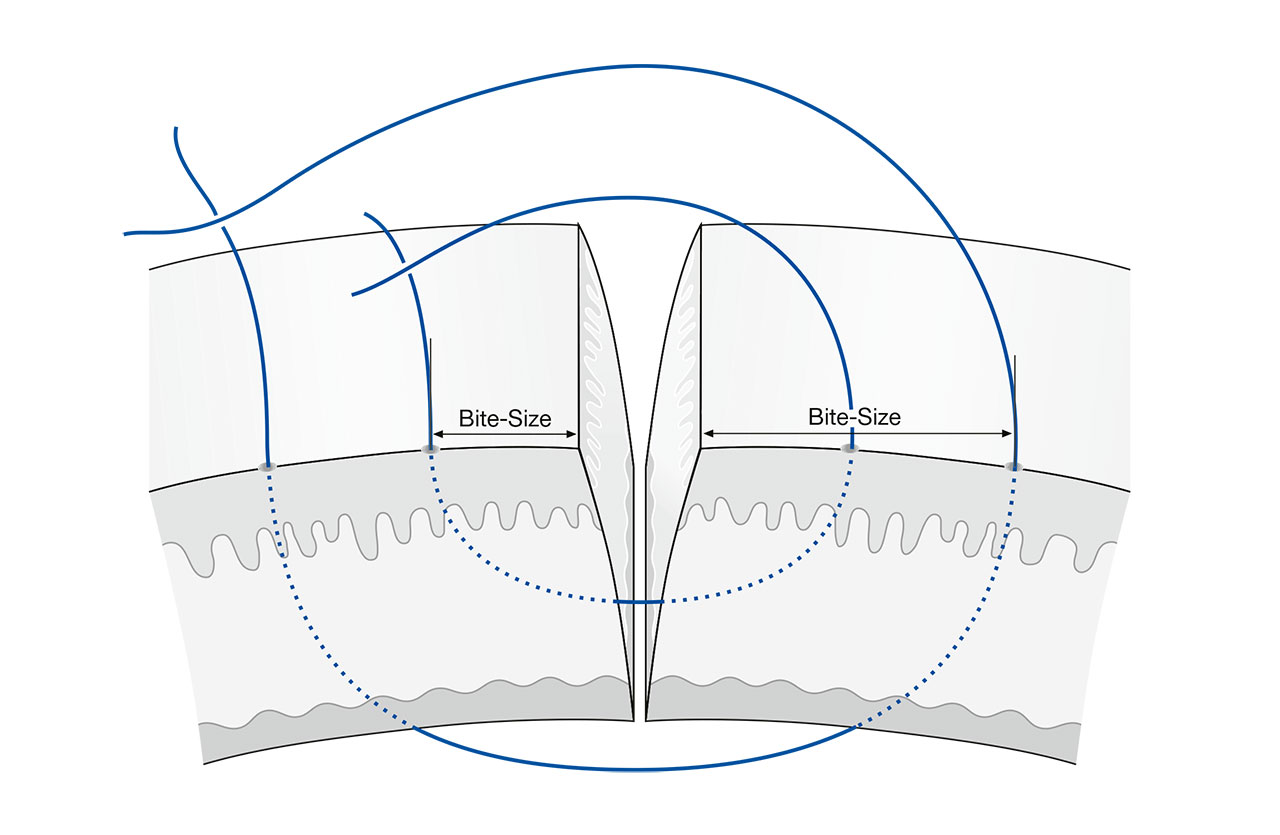 Abb. 1 Schematische Darstellung zur Veranschaulichung der Bite-Size.