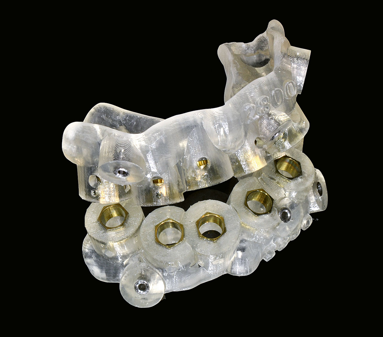Abb. 21 Mit einem stereolithografischen Verfahren hergestellte Implantat-Bohrschablone im Oberkiefer.