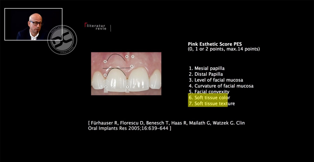 Prof. Markus Hürzeler erläutert das Weichgewebsmanagement vor und während der Implantation. (Screenshot: DC Curriculum Implantology)