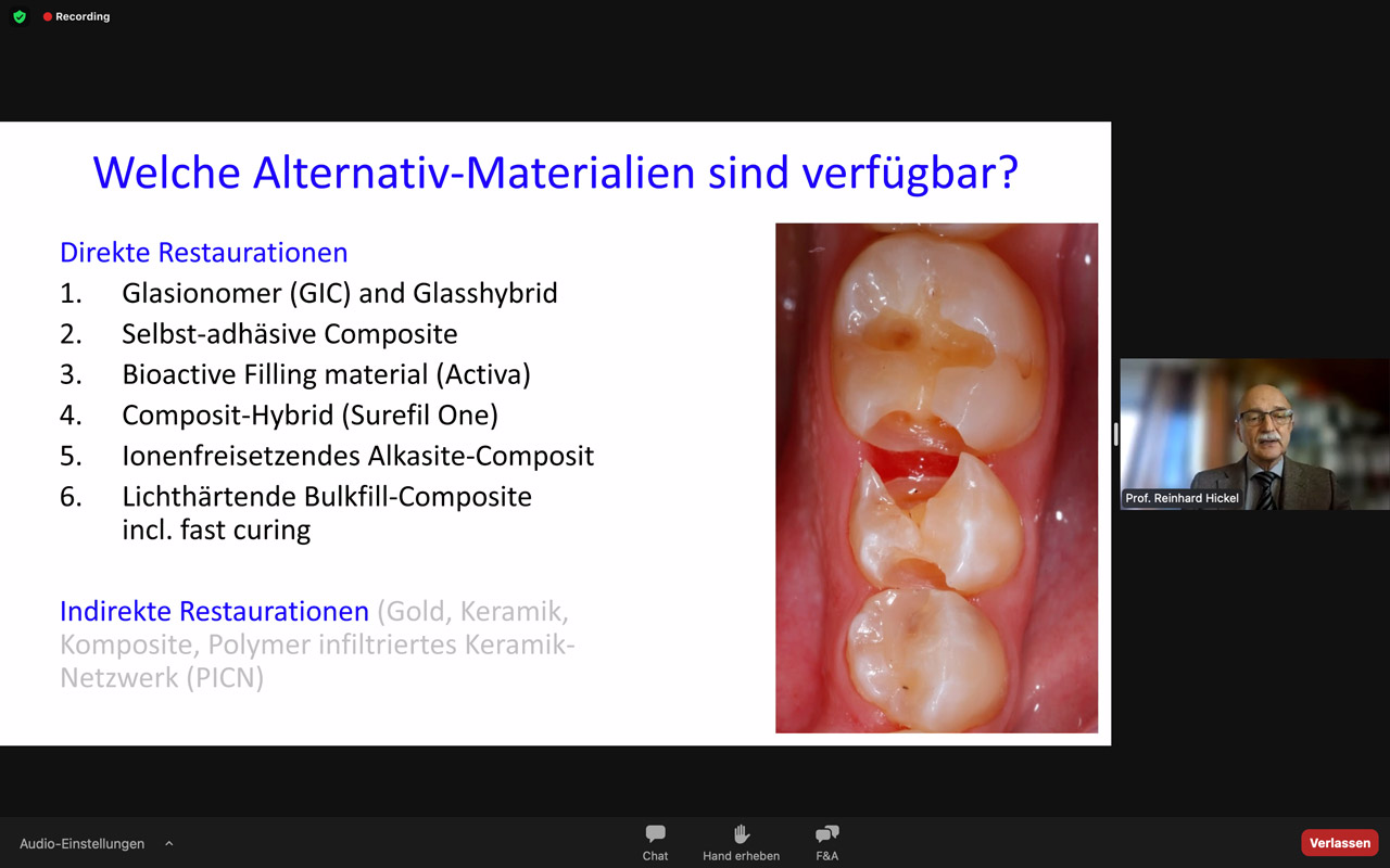 Bewährte Alternativen zu Amalgam präsentierte Prof. Reinhard Hickel.
