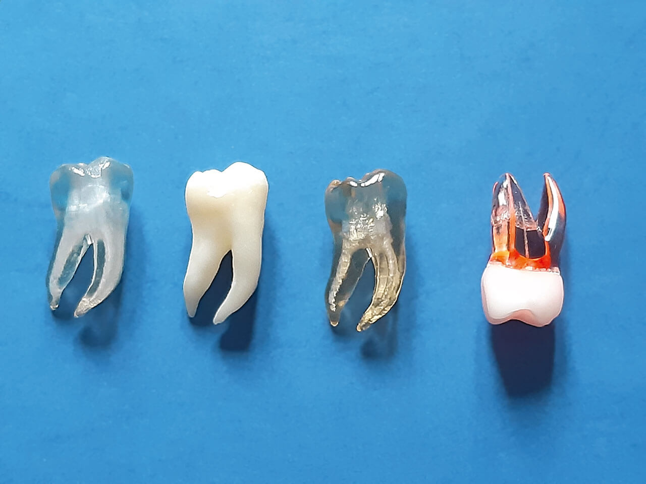 Abb. 5  Unterschiedliche Varianten 3-D-gedruckter Zähne.