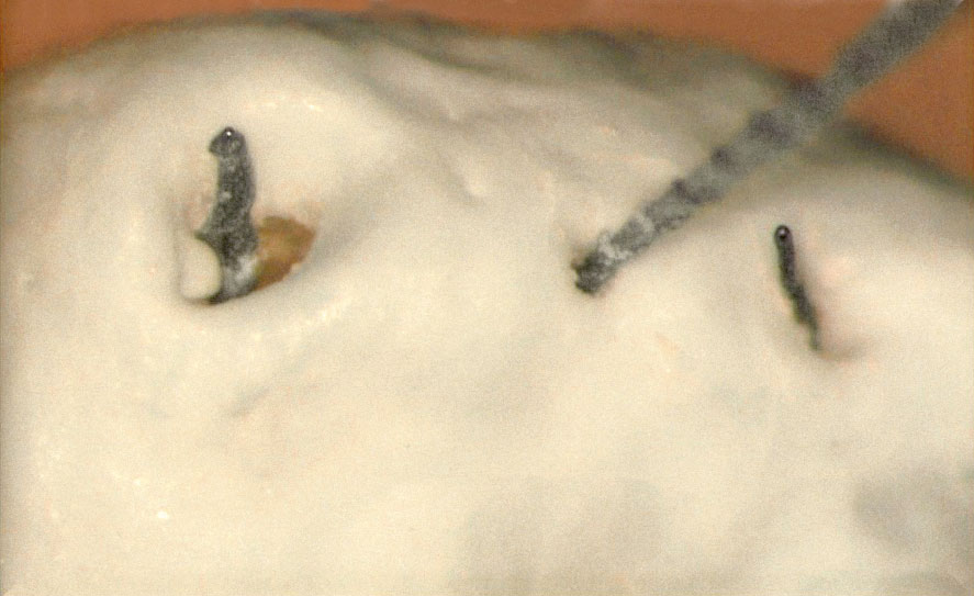 Abb. 4 Ansicht einer Wurzelspitze mit mehreren apikalen Foramina.