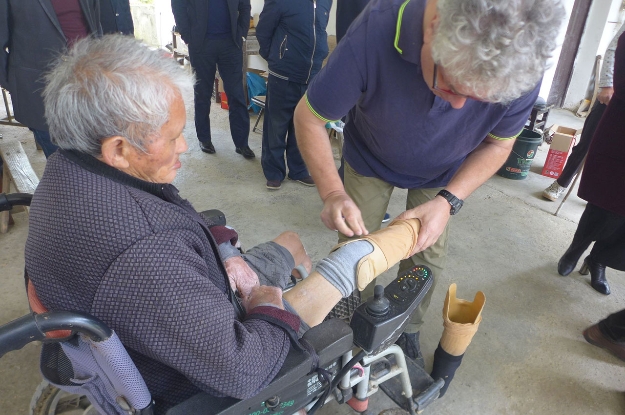 In China ist der HDZ in der Leprahilfe aktiv. Hier wird einem Leprapatienten eine Beinprothese angepasst.
