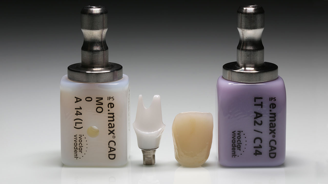 Abb. 3: Lithiumdisilikatkeramik als Werkstoff für Abutment und Implantatkrone. 