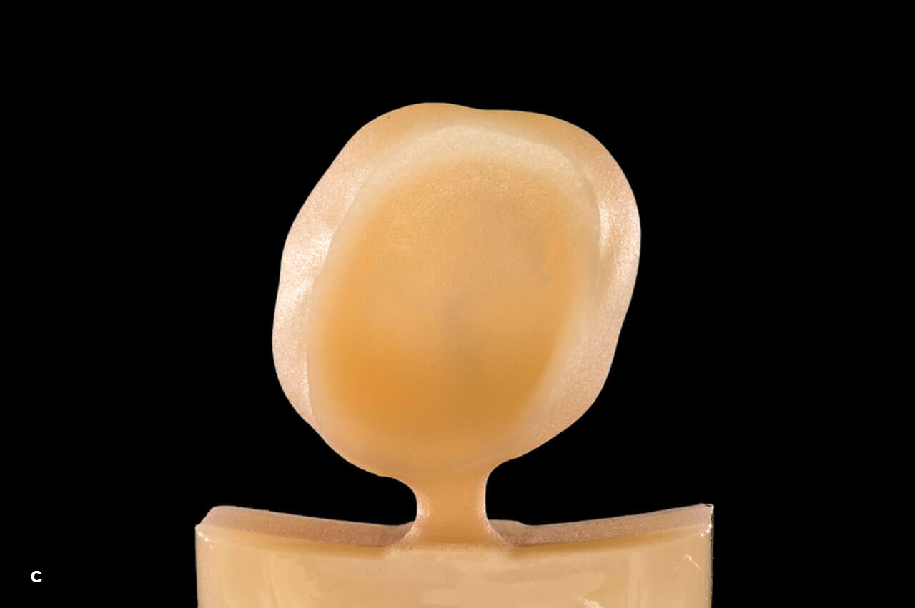 Abb. 10 Okklusale (a), disto-okklusale (b), zervikale (c) und mesio-zervikale Ansicht der Krone aus Cerec Tessera für Zahn 26 (d). Der Kronenrand stellt sich praktisch ohne jegliches Chipping dar.