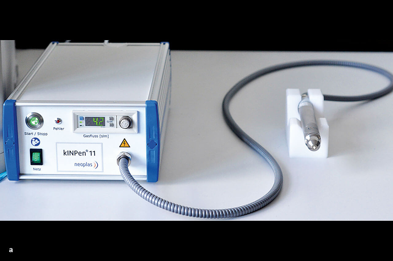 Abb. 1a Plasmaanlage (kINPen 11, neoplas med,  Deutschland) zur Herstellung eines kalten Atmosphärenplasmas (CAP) für die dentale Anwendung.