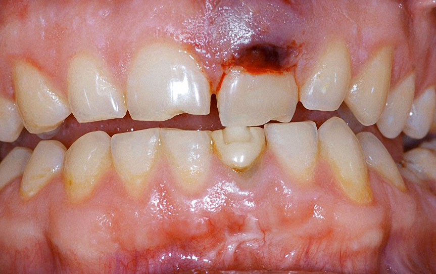 Abb. 1 Dentales Erscheinungsbild bei Erstvorstellung.