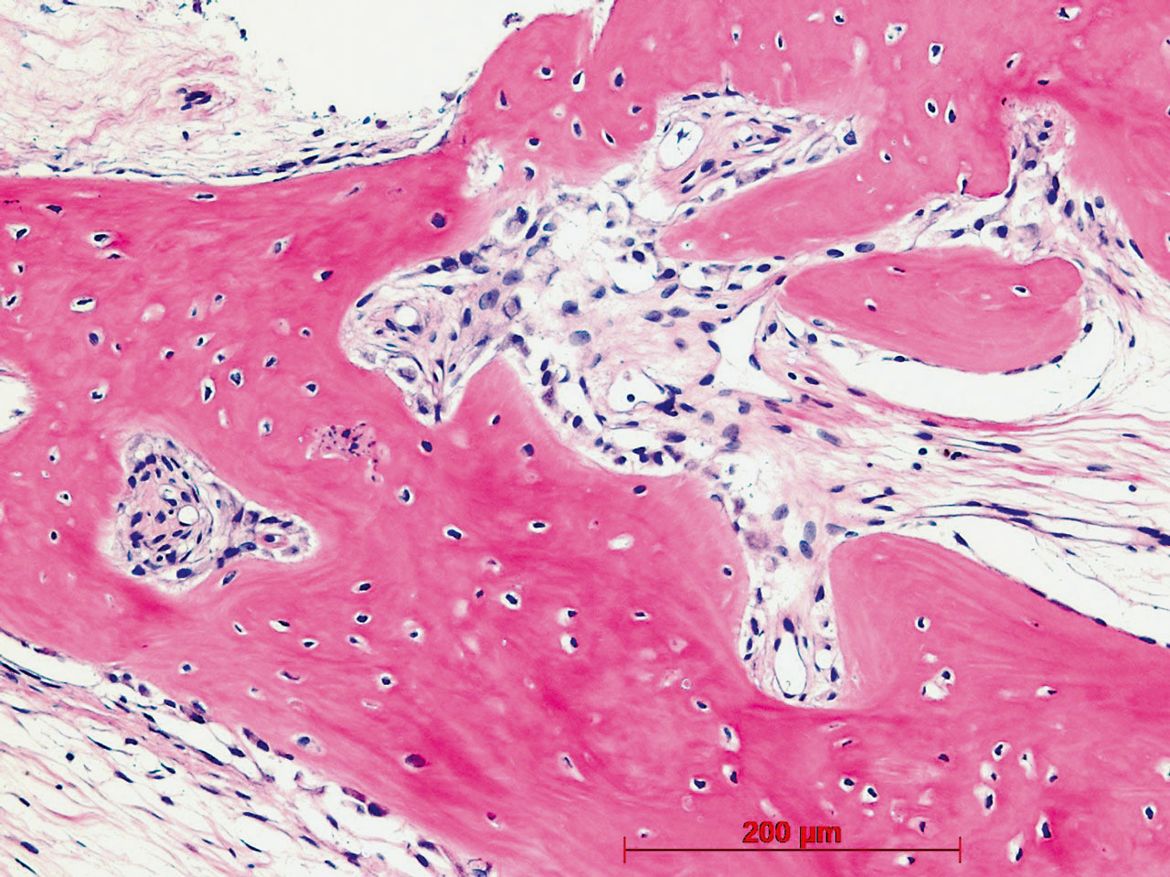 Abb. 12c Spongiosa mit Osteoblastenaggregaten; HE-Färbung, x 20.