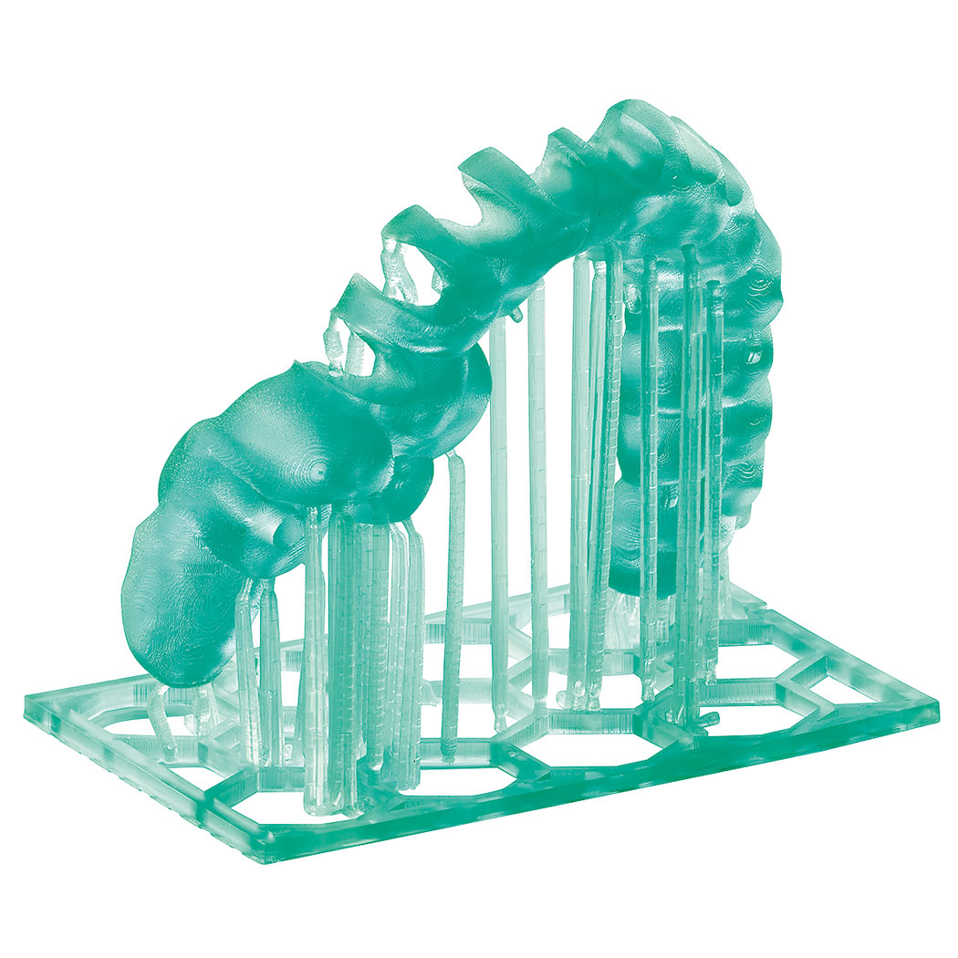 Eine 3-D-gedruckte Bohrschablone aus dem dampfsterilisierbaren Material M-PRINT Surgical guide HT vor der Nachbearbeitung. Zu sehen sind die noch vorhandenen Supportstrukturen und die Wabenstruktur, die einen stabilen Druck ermöglichen
