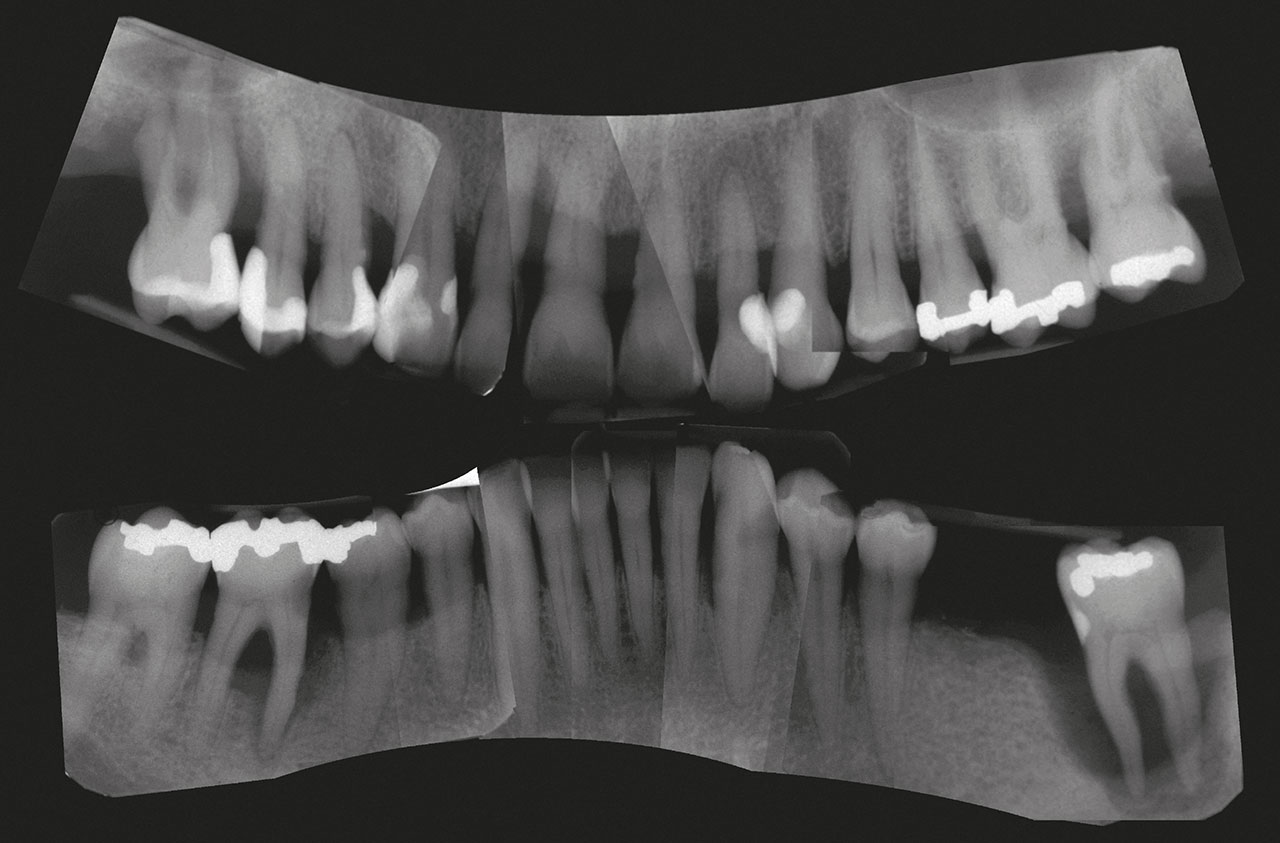 Abb. 3 Röntgen­status zum Zeitpunkt der Befundaufnahme (Juni 2014)1.