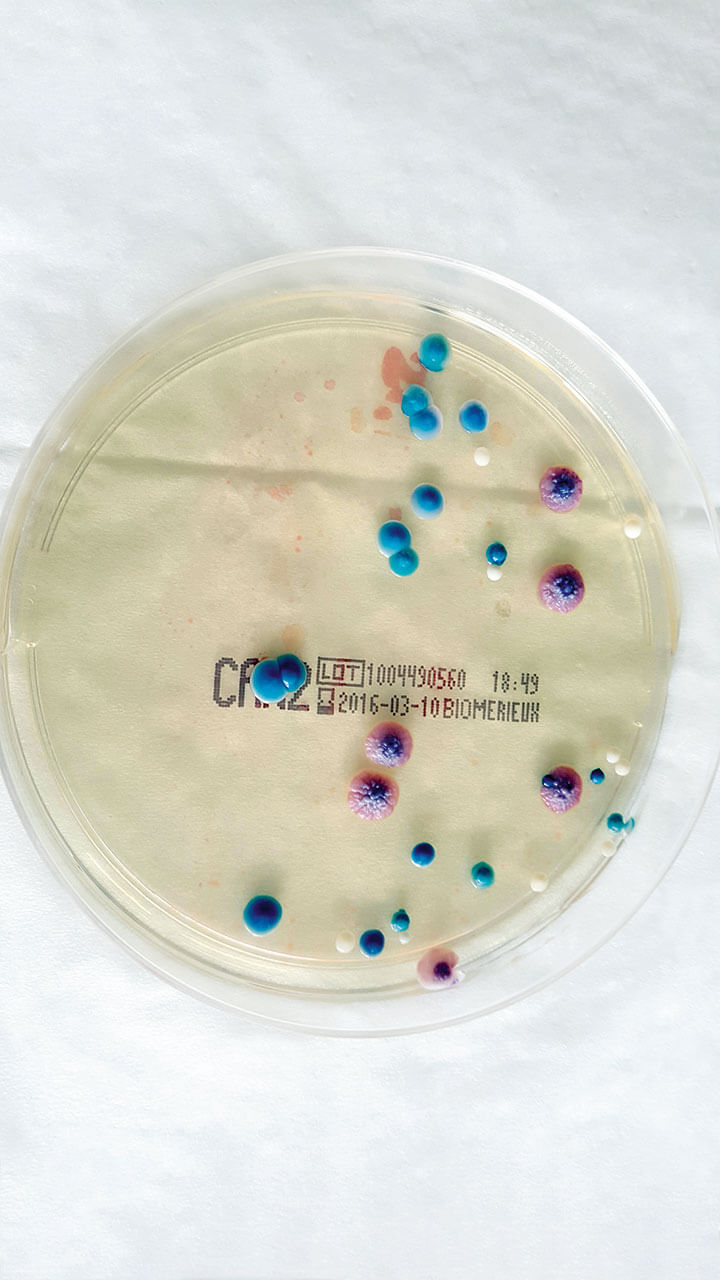 Abb. 4 Mikrobiologische Bestimmung von Candida-Spezien. Die auf der Agarplatte gewachsenen blauen Kolonien entsprechen Candida albicans, die weißen Candida glabrata und die pinkblauen Candida tropicalis.