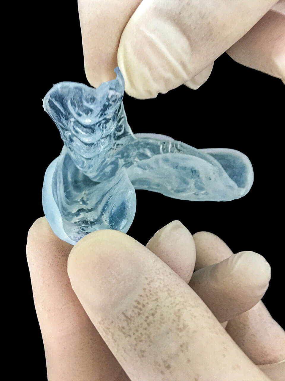 Abb. 7 Nicht korrekt angefertigter Zahnschutz: Die im Multilayer-Verfahren nacheinander tiefgezogenen Folien lösen sich bei körperlicher Belastung voneinander.