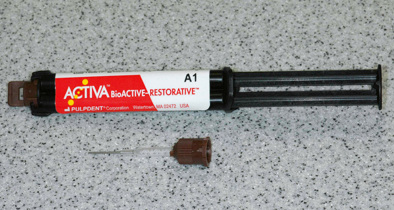 Abb. 3 Bioaktives Restaurationsmaterial (Activa BioActive-Restorative, Fa. Pulpdent/American Dental Systems, Vaterstetten) mit dazugehöriger Mischkanüle.