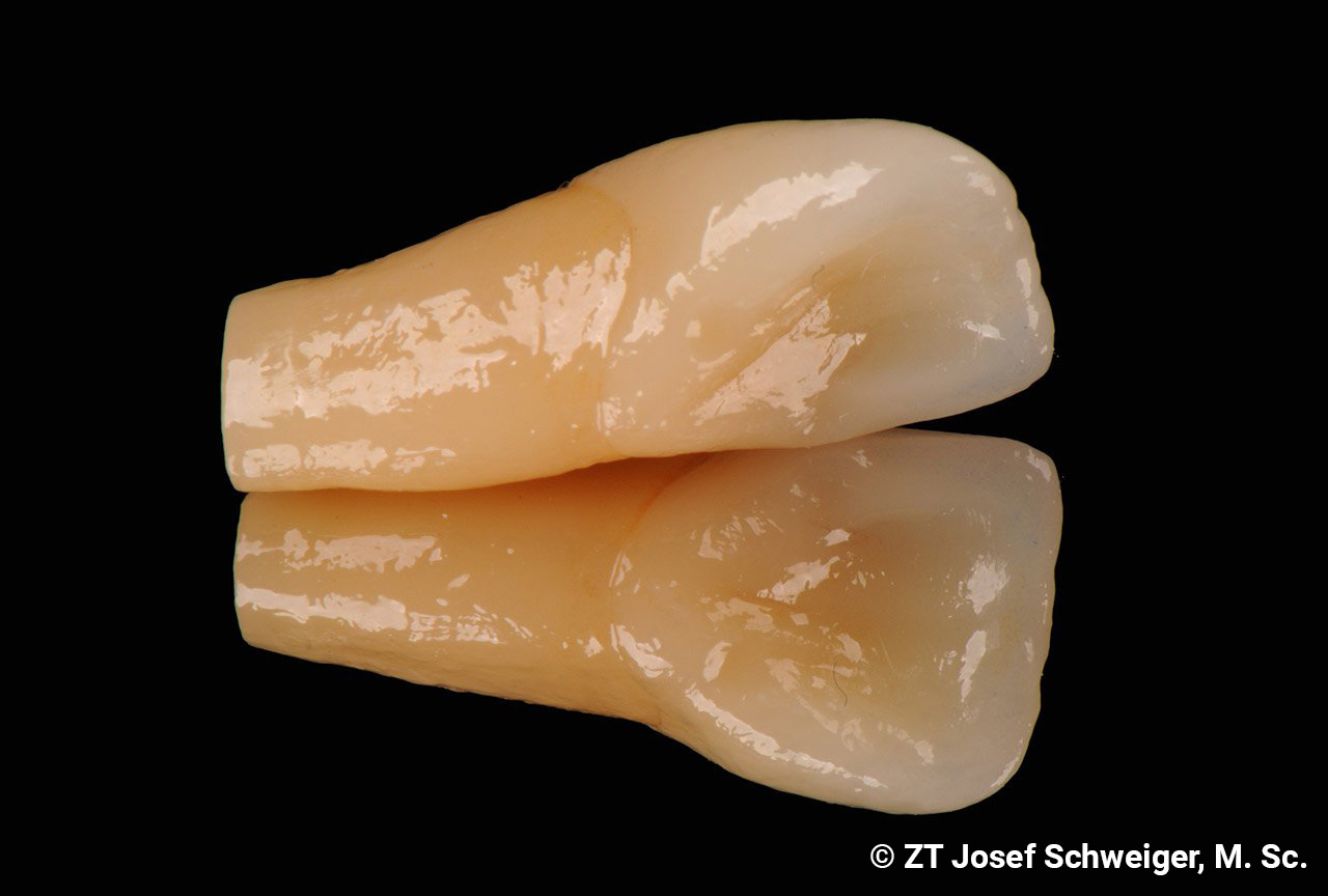 Weltneuheit: Mittels Lithoz LCM-3-D-Druckverfahren mehrschichtig gedruckte Zähne aus Lithiumdisilikat auf der Basis von Daten aus der „Schweiger Zahnstrukturdatenbank“.