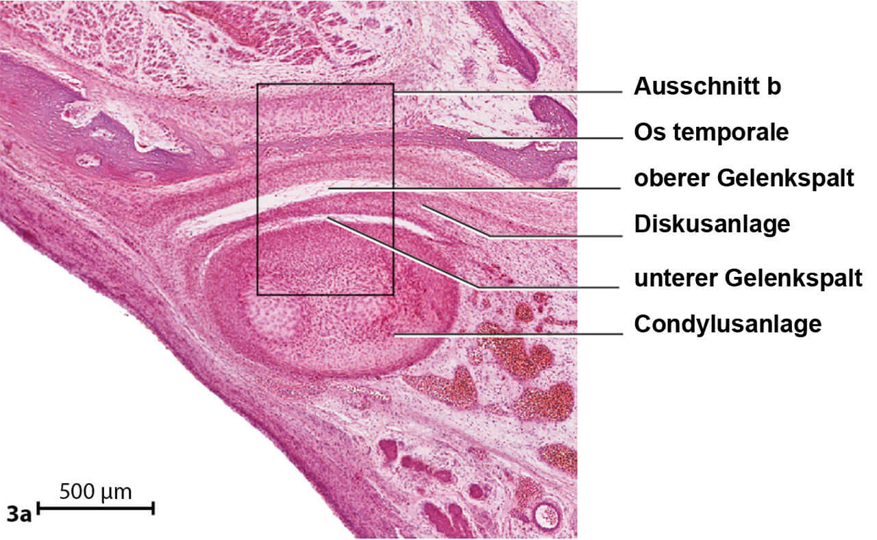 Abb. 3 Histologischer Sagittalschnitt durch die Anlageregion des Kiefergelenks bei einem menschlichen Fetus von 83 mm Scheitel-Steiß-Länge (ca. 12. Woche).  Abb 3 a Der Diskus artikularis entsteht durch Verdichtung des Mesenchyms in der Anlagenregion des Kiefergelenks. Der obere und der untere Gelenkspalt entstehen durch Einreißen des mesenchymalen Zellverbundes.