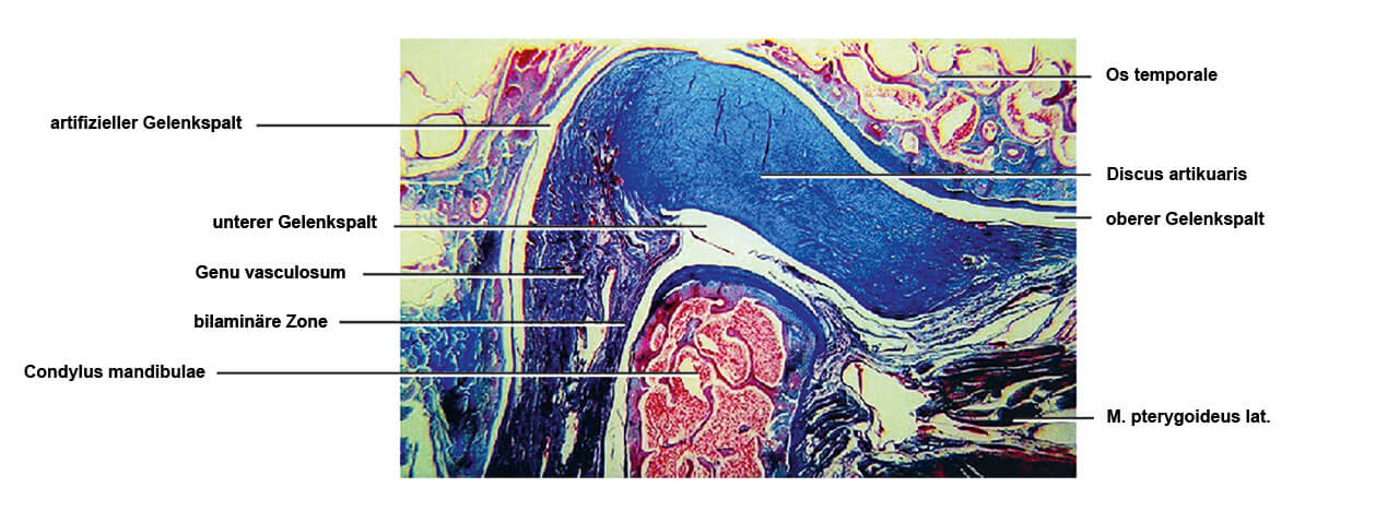 Abb. 7 Histologischer Sagittalschnitt durch das Kiefergelenk eines Erwachsenen. Färbung: Trichrom. Original: A. Puff, München [56].