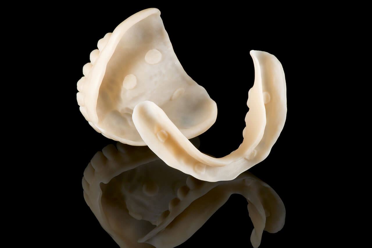 Abb. 2 Individuelle Funktionslöffel mit Zahnkranz.