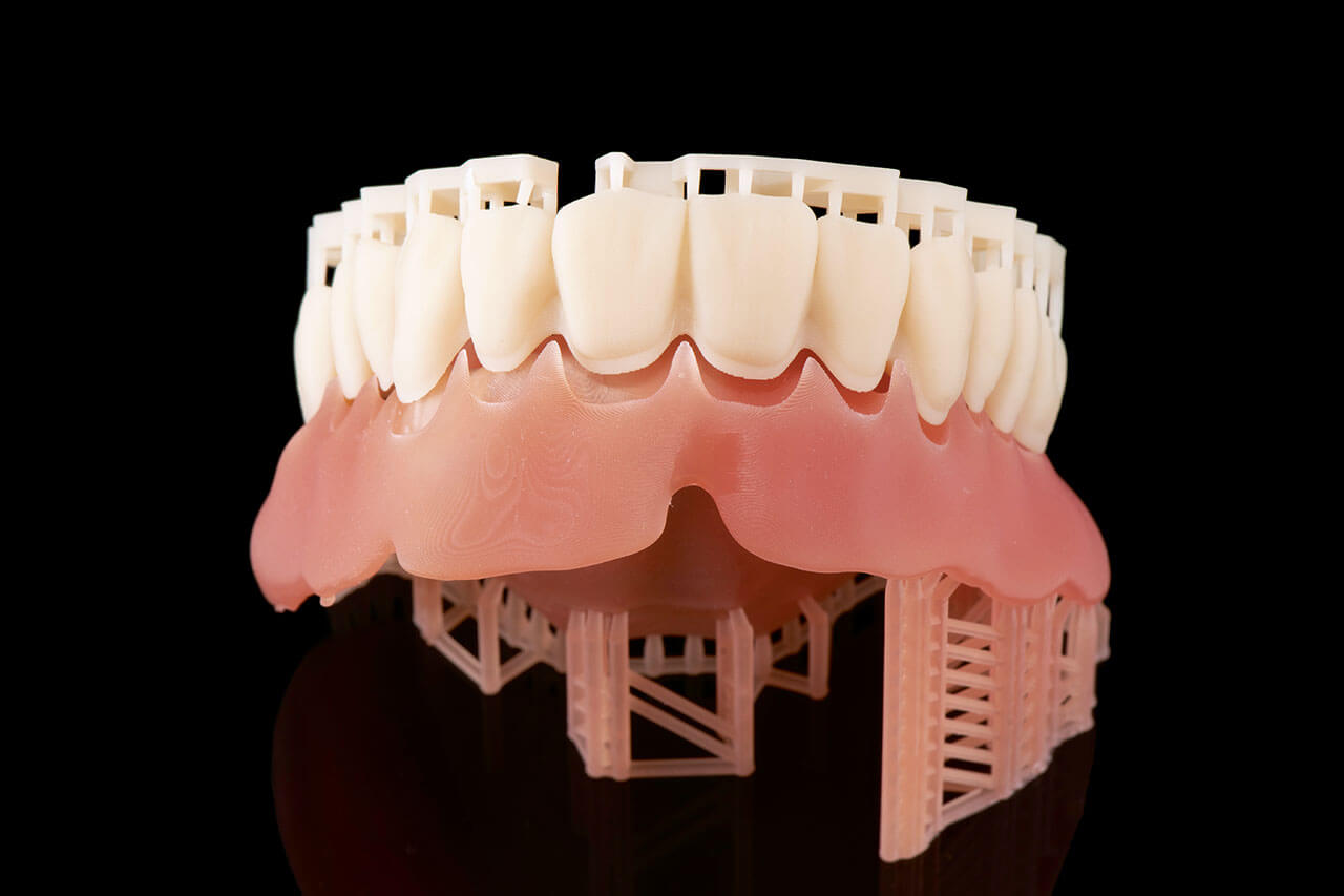 Abb. 7 Separat gedruckte Prothesenbasis und Zahnkranz.