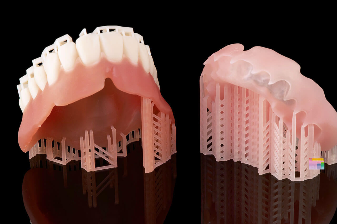 Abb. 8 Zahnkranz mit eingeklebter und additiv gefertigter Prothesenbasis.