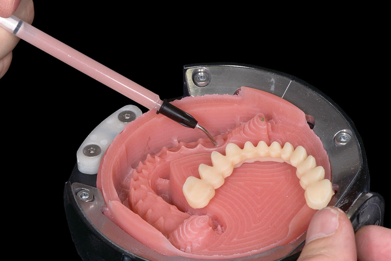 Abb. 9 Digital gefräste Prothesenbasis mit fein ausgefrästen Garagen und Zahnkranz fertig zum Verkleben.