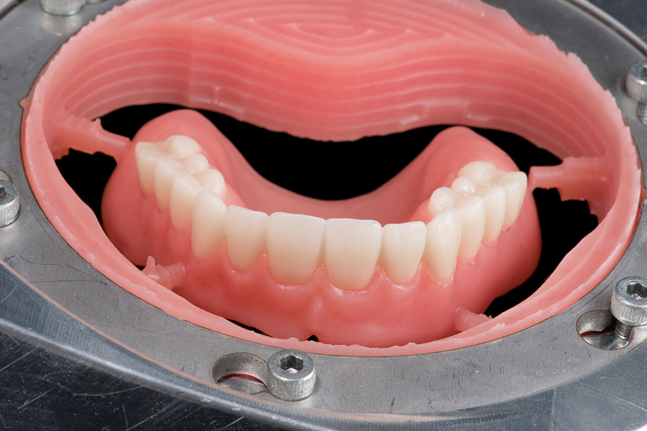 Abb. 10 Eingeklebter Zahnkranz, fertig für den finalen Fräsvorgang.