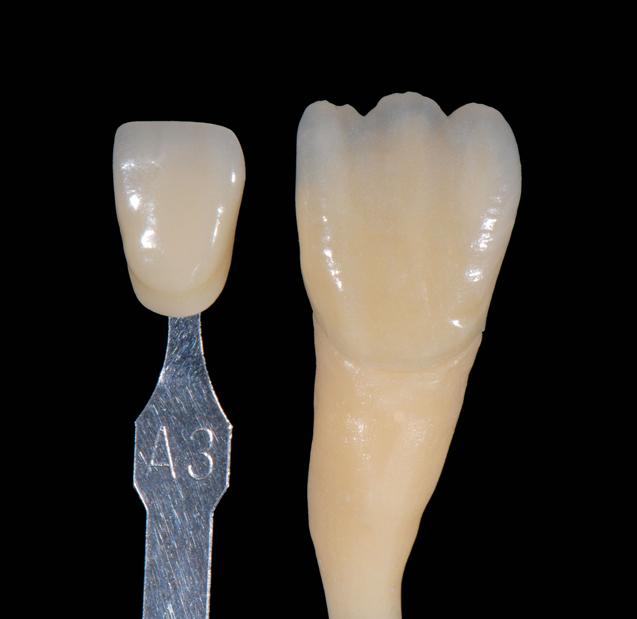 Abb. 10 Chromadentin, Dentin und Opalschneide im richtigen Verhältnis zueinander angewendet reichen aus, um Restaurationen nach Farbschlüssel umzusetzen.