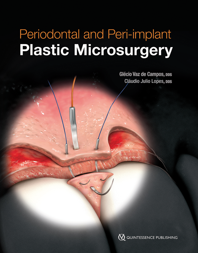 de Campos: Periodontal and Peri-implant Plastic Microsurgery
