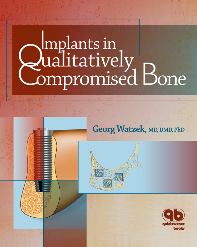 Watzek: Implants in Qualitatively Compromised Bone