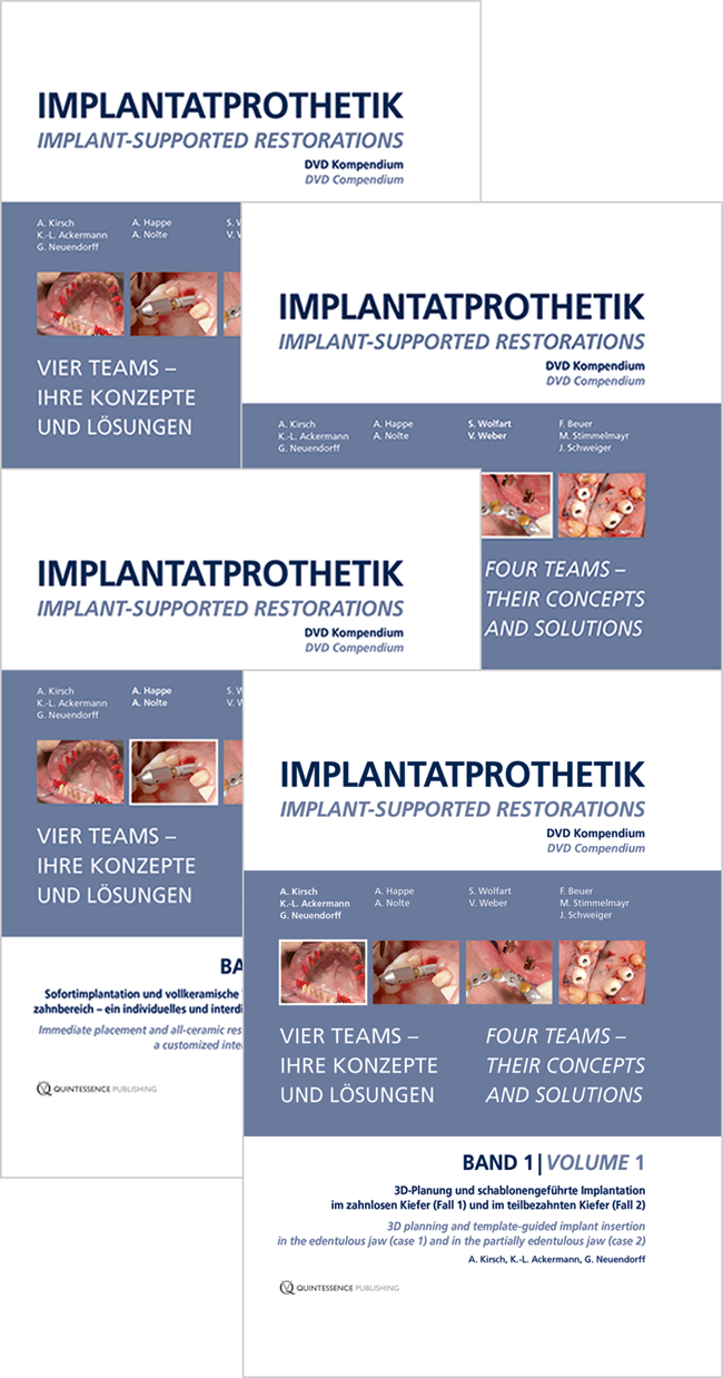 Kirsch: Implantatprothetik / Implant-supported restorations