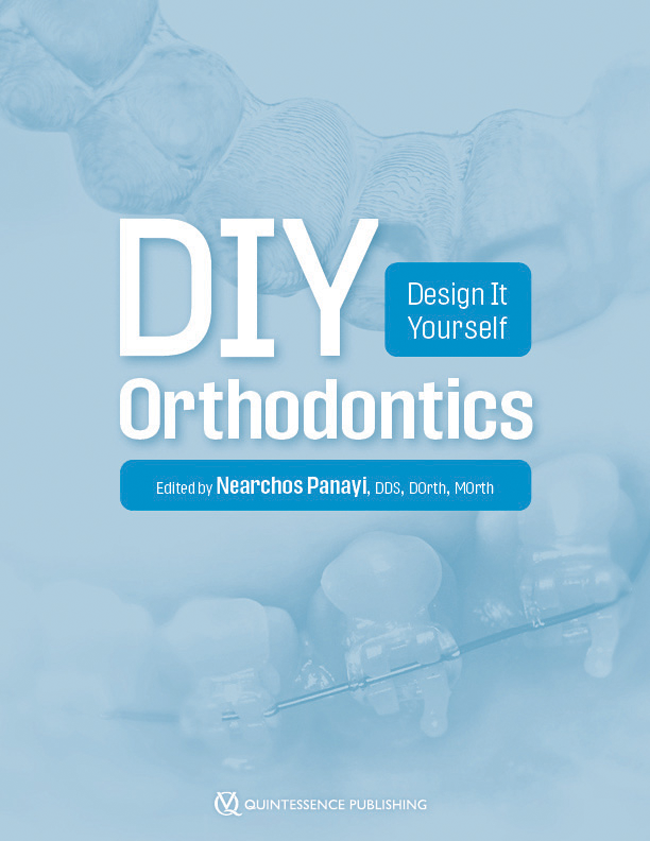 Panayi: DIY Orthodontics