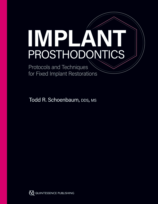 Schoenbaum: Implant Prosthodontics