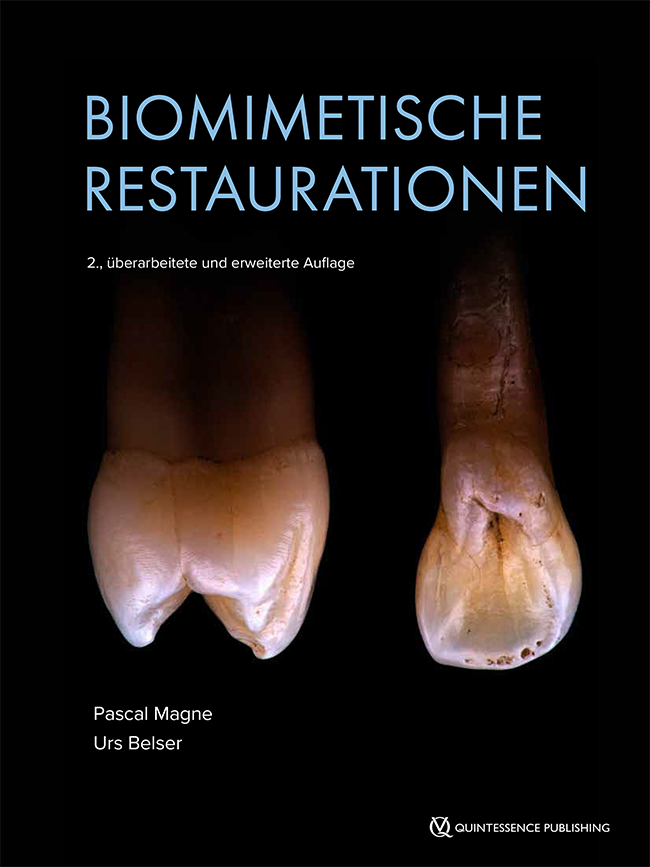 Magne: Biomimetische Restaurationen