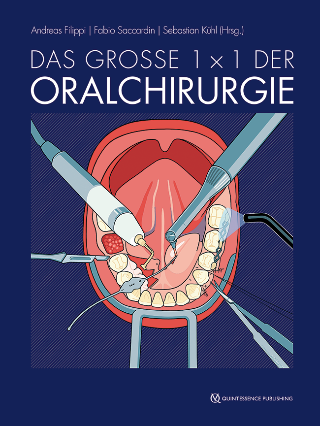 Filippi: Das große 1 x 1 der Oralchirurgie