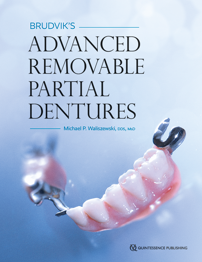 Waliszewski: Brudviks Advanced Removable Partial Dentures