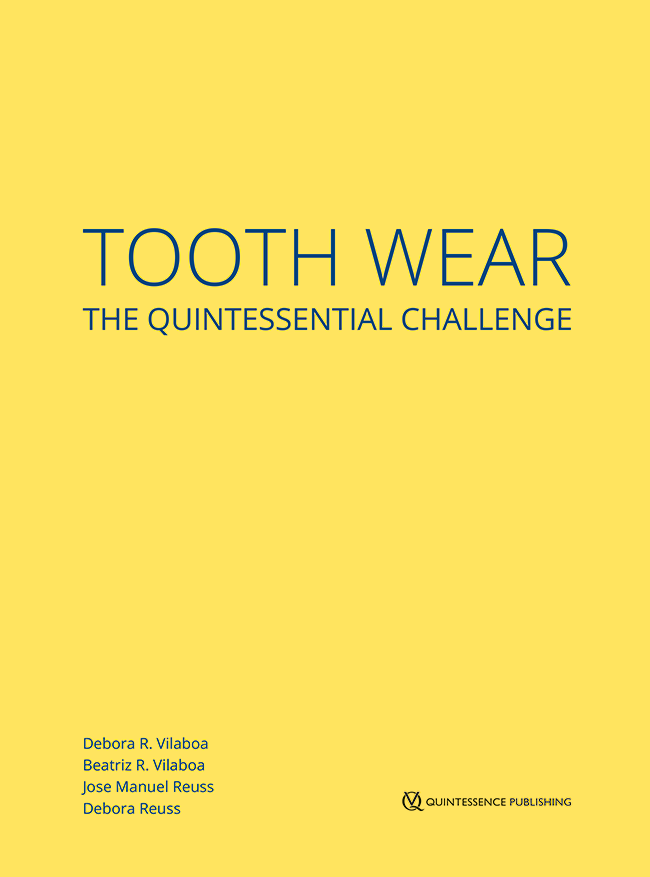 Vilaboa: Tooth Wear