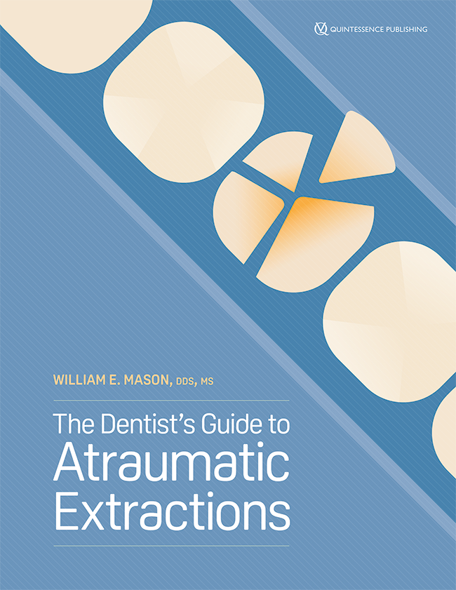Mason: The Dentists Guide to Atraumatic Extractions
