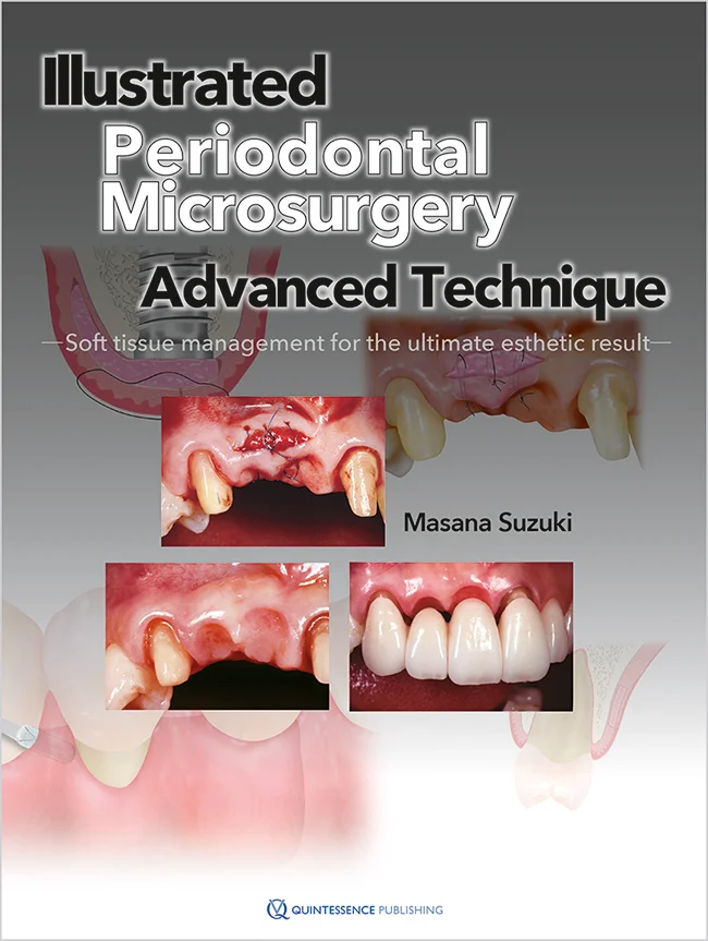 Cosmetic Periodontal Procedures - Dr. Suzanne Caudry