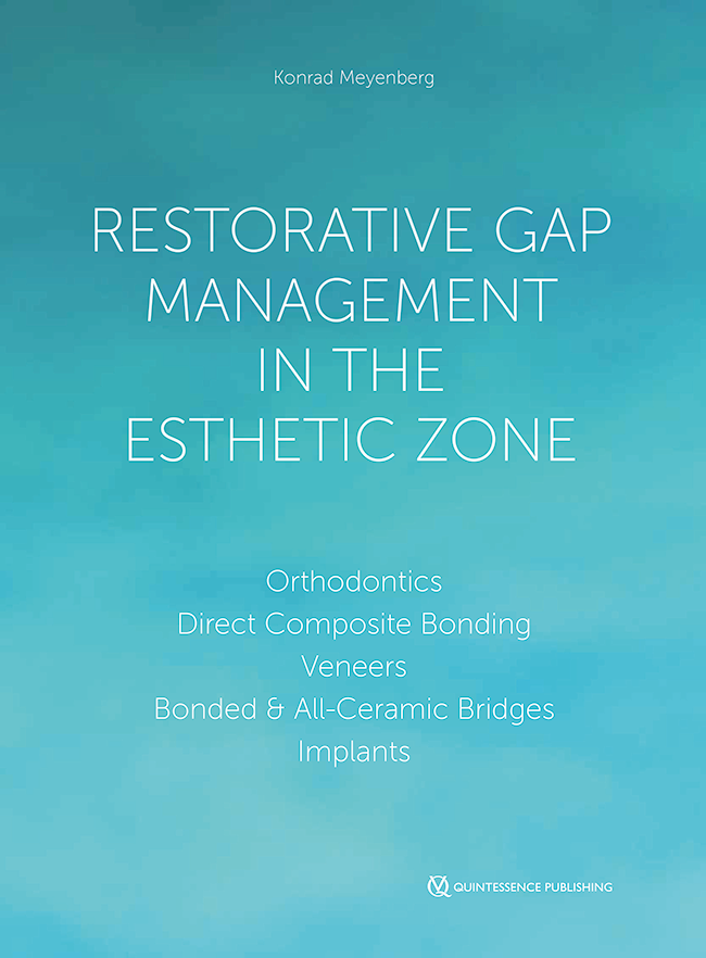 Meyenberg: Restorative Gap Management in the Esthetic Zone