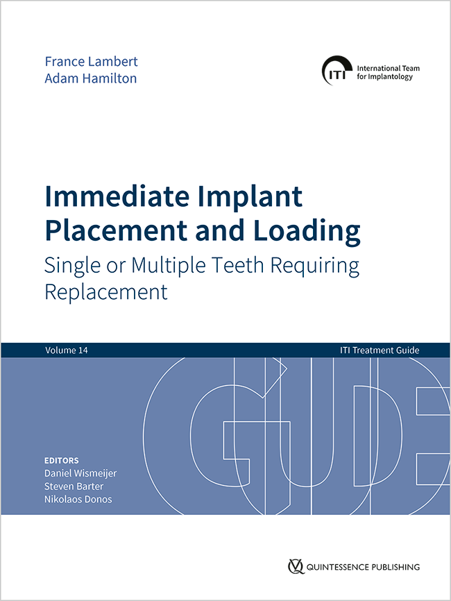 Wismeijer: Immediate Implant Placement and Loading – Single or Multiple Teeth Requiring Replacement